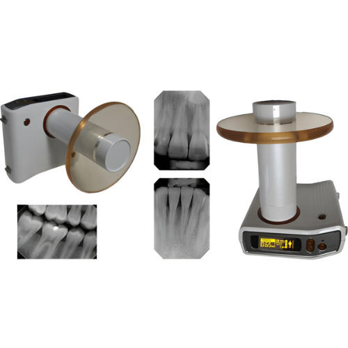 Chairside Imaging Bundle - MobileX Handheld Xray Generator and 2 x Schick CDR Elite Sensors