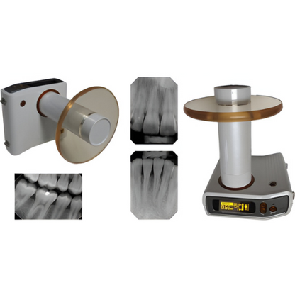 Chairside Imaging Bundle - MobileX Handheld Xray Generator and 2 x Schick CDR Elite Sensors