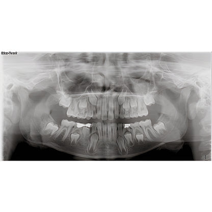 Owandy iMax Touch Pan + CBCT