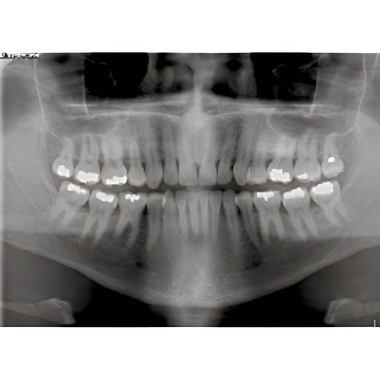 Owandy iMax Touch Pan + CBCT
