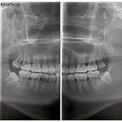 Owandy iMax Touch Pan + CBCT
