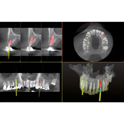 Owandy iMax Touch Pan + CBCT