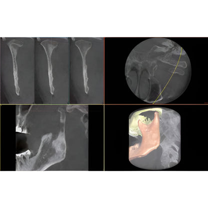 Owandy iMax Touch Pan + CBCT