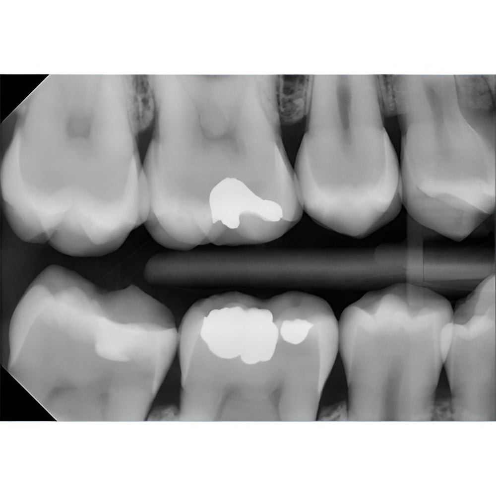 Planmeca ProSensor HD Digital Sensor with Warranty
