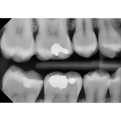 Planmeca ProSensor HD Digital Sensor with Warranty