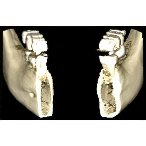 Planmeca ProMax Pan + Ceph + CBCT (8x8 FOV) with PC, Software, Installation, Shipping and Warranty