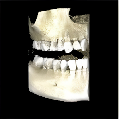 Planmeca ProMax Pan + Ceph + CBCT (8x8 FOV) with PC, Software, Installation, Shipping and Warranty