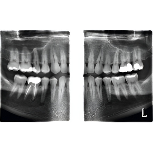 Planmeca ProMax Pan + Ceph + CBCT (8x8 FOV) with PC, Software, Installation, Shipping and Warranty