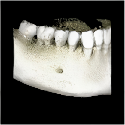 Planmeca ProMax Pan + Ceph + CBCT (8x8 FOV) with PC, Software, Installation, Shipping and Warranty