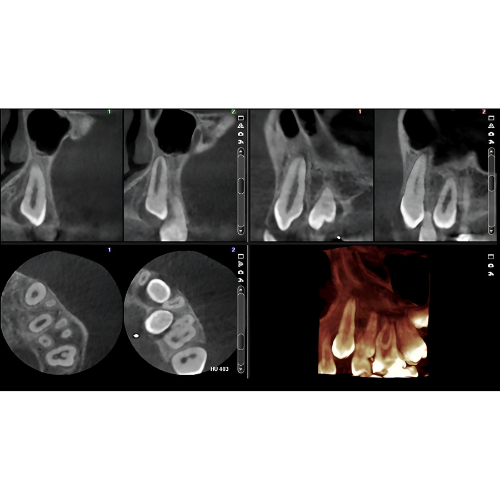 Planmeca ProMax Pan + Ceph + CBCT (8x8 FOV) with PC, Software, Installation, Shipping and Warranty