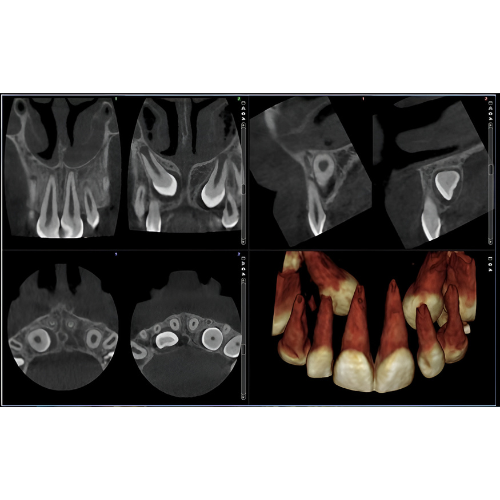 Planmeca ProMax Pan + Ceph + CBCT (8x8 FOV) with PC, Software, Installation, Shipping and Warranty