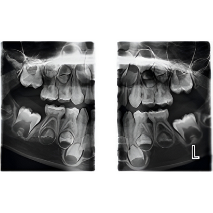 Planmeca ProMax Pan + Ceph + CBCT (8x8 FOV) with PC, Software, Installation, Shipping and Warranty