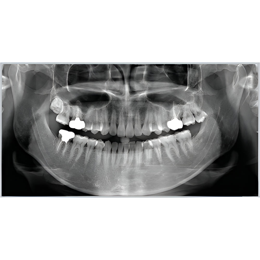 RayScan Alpha Pan + CBCT (10x10 FOV)