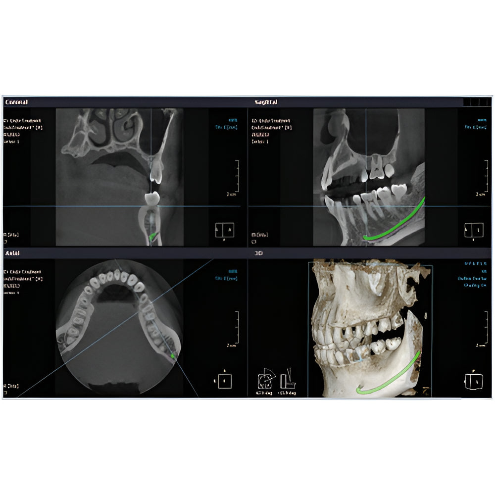 RayScan Alpha Pan + CBCT (10x10 FOV)