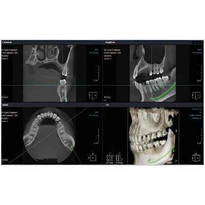 RayScan Alpha Pan + CBCT (10x10 FOV)