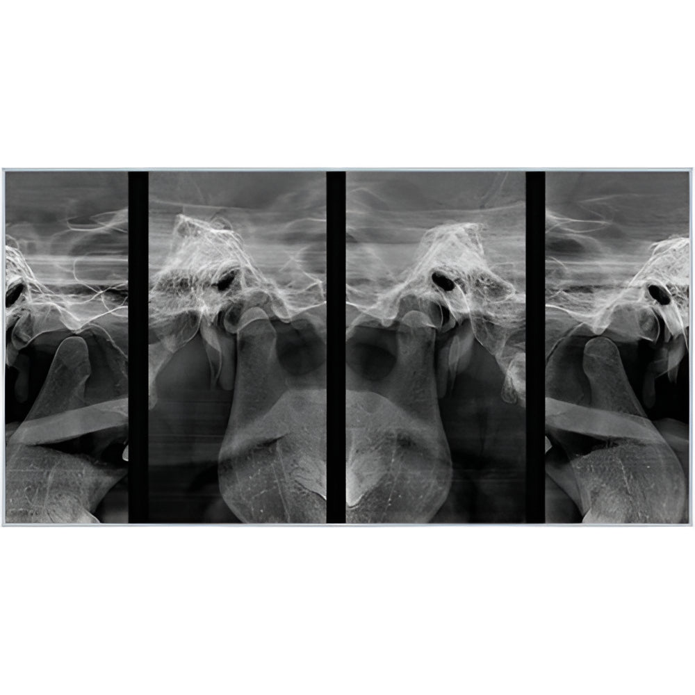 RayScan Alpha Pan + CBCT (10x10 FOV)
