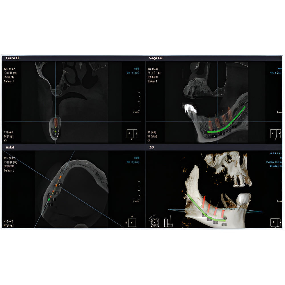 RayScan Alpha Pan + CBCT (10x10 FOV)
