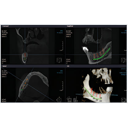 RayScan Alpha Pan + CBCT (10x10 FOV)