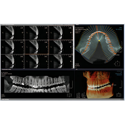 RayScan Alpha Expert Pan + CBCT (9x9 FOV) with PC, Software, Installation, Shipping and Warranty
