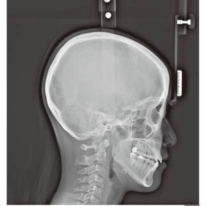RayScan Alpha Expert Pan + Ceph + CBCT (9x9 FOV) with PC, Software, Installation, Shipping and Warranty