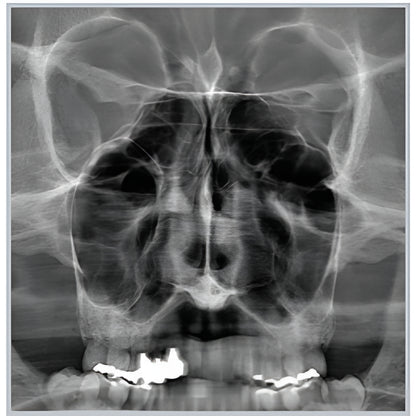 RayScan Alpha Expert Pan + Ceph + CBCT (9x9 FOV) with PC, Software, Installation, Shipping and Warranty