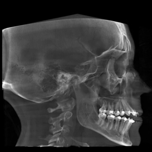 Planmeca ProMax Mid Pan + Ceph + CBCT (20x17 FOV)