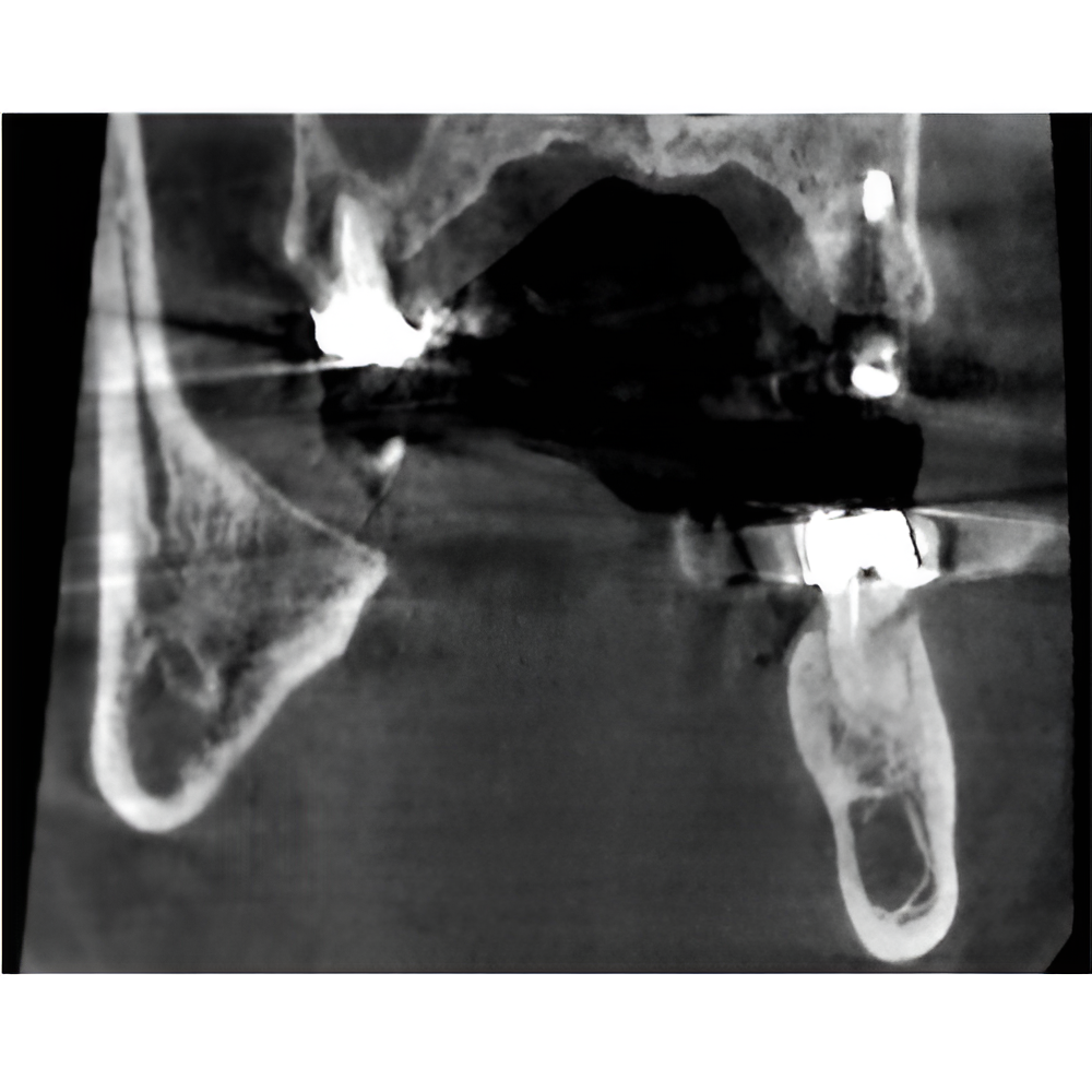 2023 Vatech A9 Pan + CBCT (8x8 FOV)