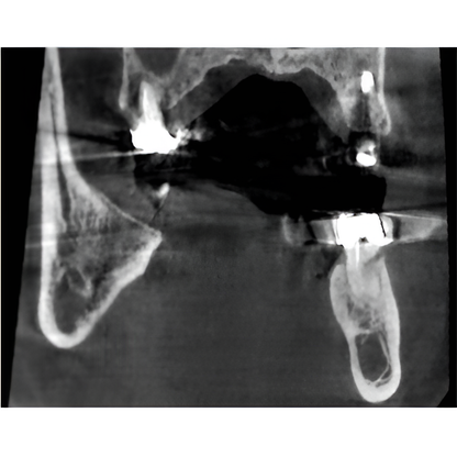 2023 Vatech A9 Pan + CBCT (8x8 FOV)