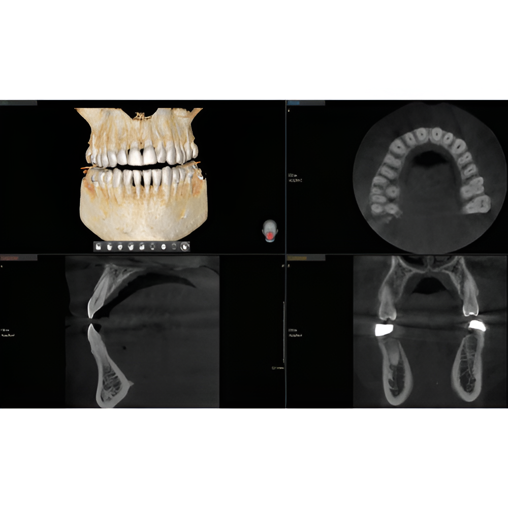 2023 Vatech A9 Pan + CBCT (8x8 FOV)