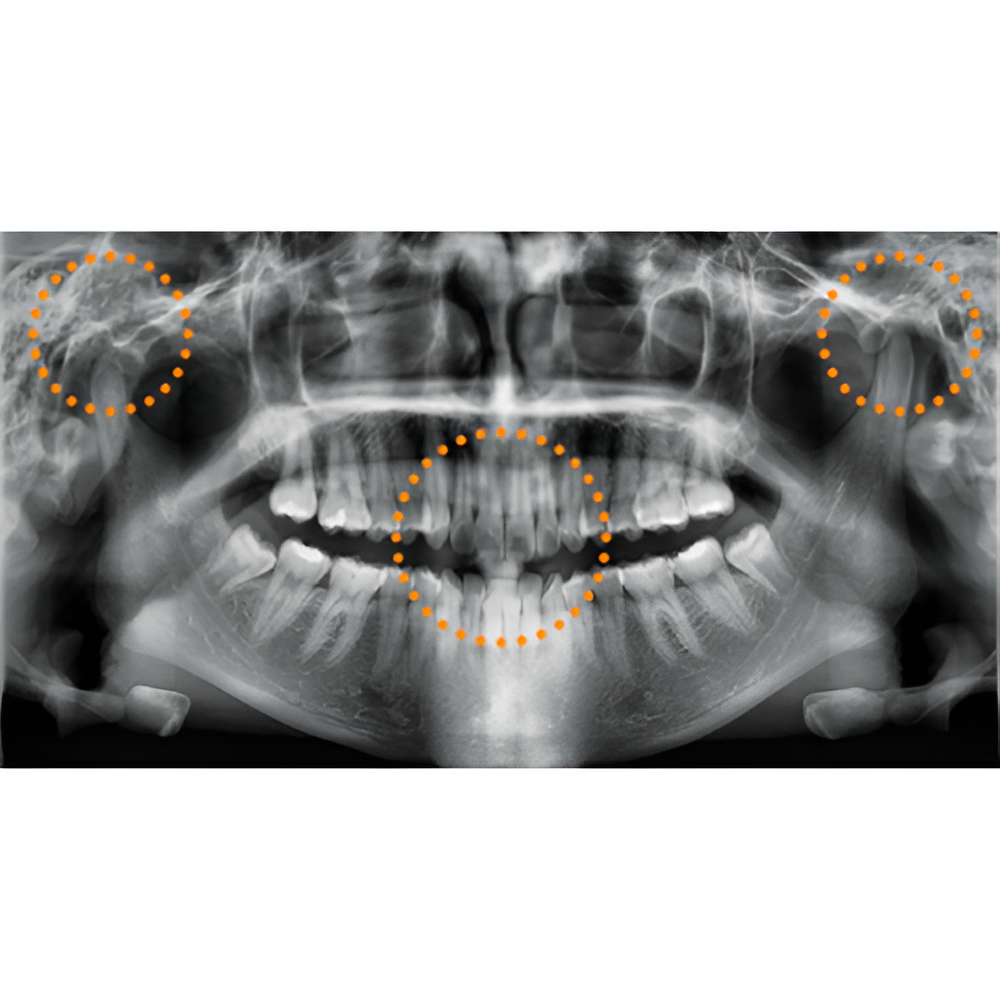 2023 Vatech A9 Pan + CBCT (8x8 FOV)