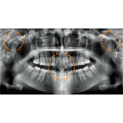 2023 Vatech A9 Pan + CBCT (8x8 FOV)