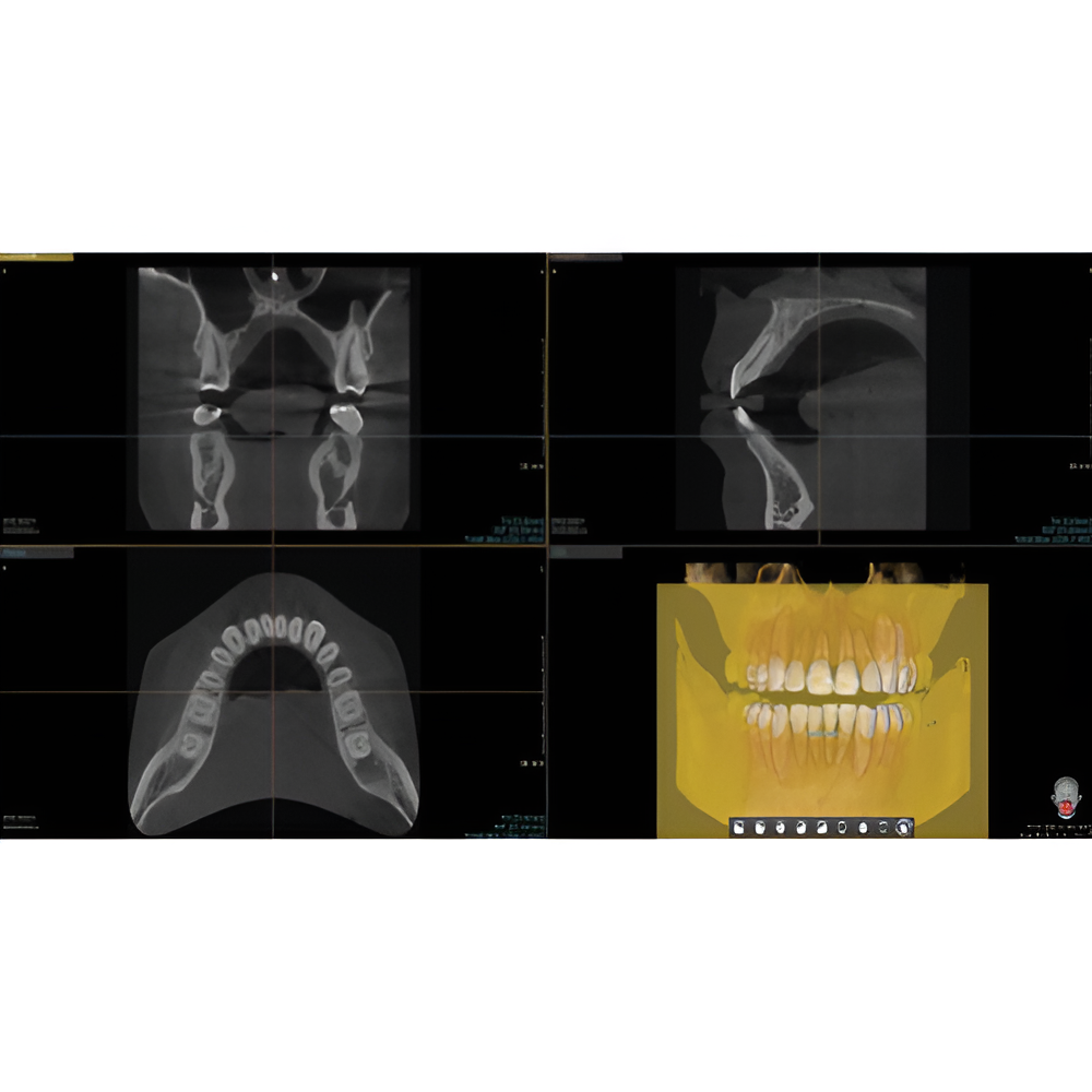 2023 Vatech A9 Pan + CBCT (8x8 FOV)