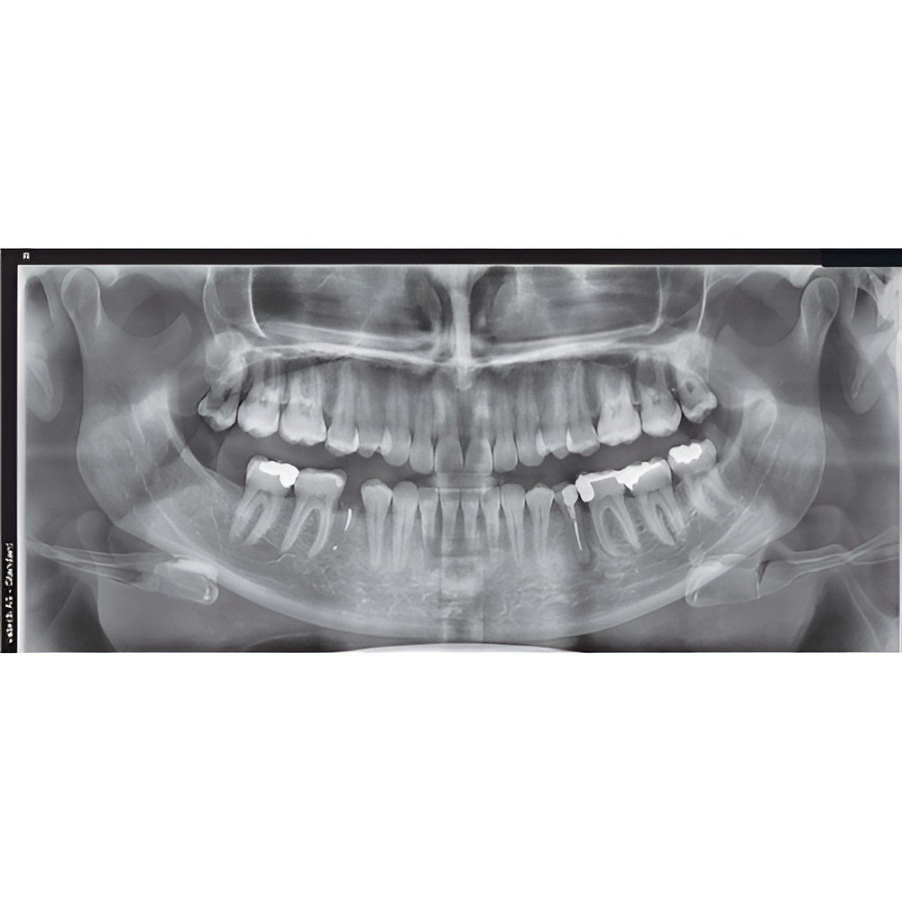 2023 Vatech A9 Pan + CBCT (8x8 FOV)