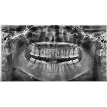 Vatech PaX-i3D Pan + CBCT (8x8 FOV)