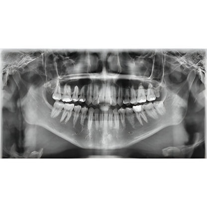 Vatech PaX-i3D Pan + CBCT (8x8 FOV)