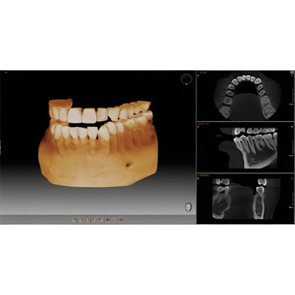 Vatech PaX-i3D Pan + CBCT (8x8 FOV)