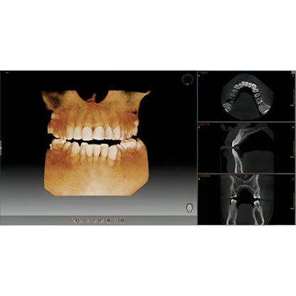 Vatech PaX-i3D Pan + CBCT (8x8 FOV)