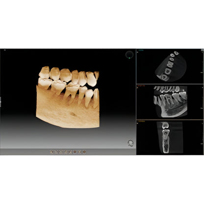 Vatech PaX-i3D Pan + CBCT (8x8 FOV)