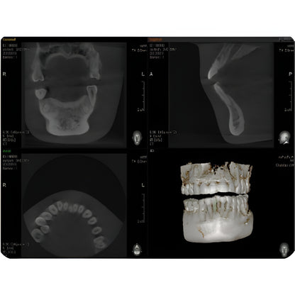 Vatech PaX-i3D Pan + CBCT (8x8 FOV)
