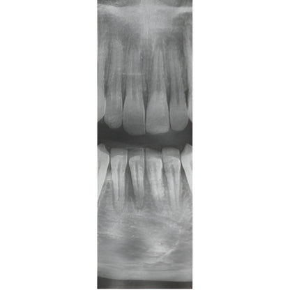 Vatech PaX-i3D Pan + CBCT (8x8 FOV)