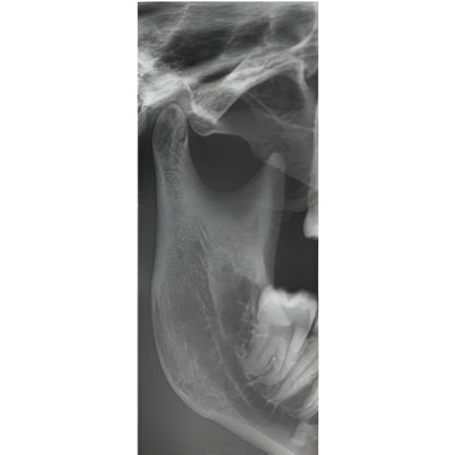 Vatech PaX-i3D Pan + CBCT (8x8 FOV)