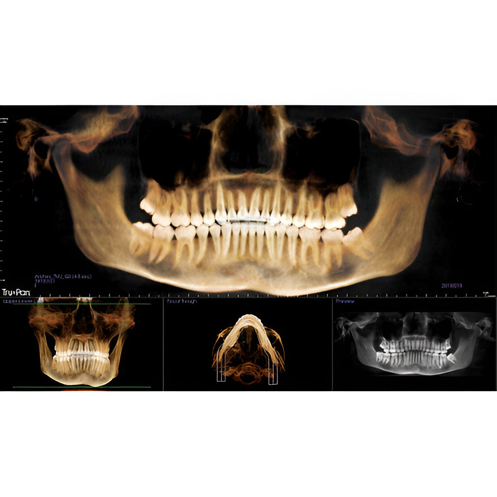 i-CAT FLX V10 Pan + CBCT (16x10 FOV)