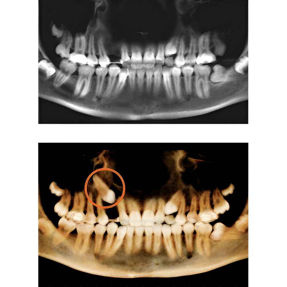 i-CAT FLX V10 Pan + CBCT (16x10 FOV)