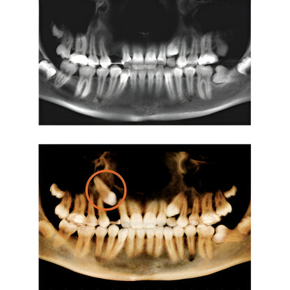i-CAT FLX V10 Pan + CBCT (16x10 FOV)