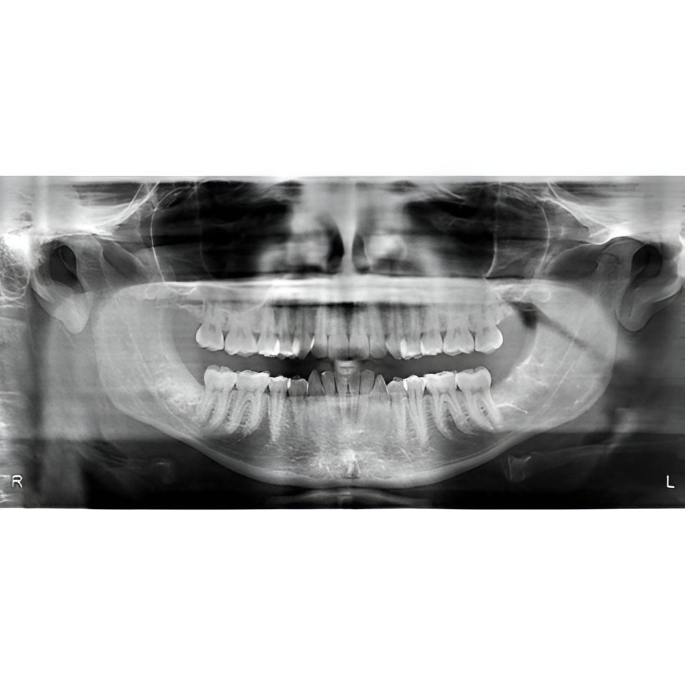 i-CAT FLX V10 Pan + CBCT (16x10 FOV)