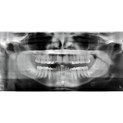 i-CAT FLX V10 Pan + CBCT (16x10 FOV)