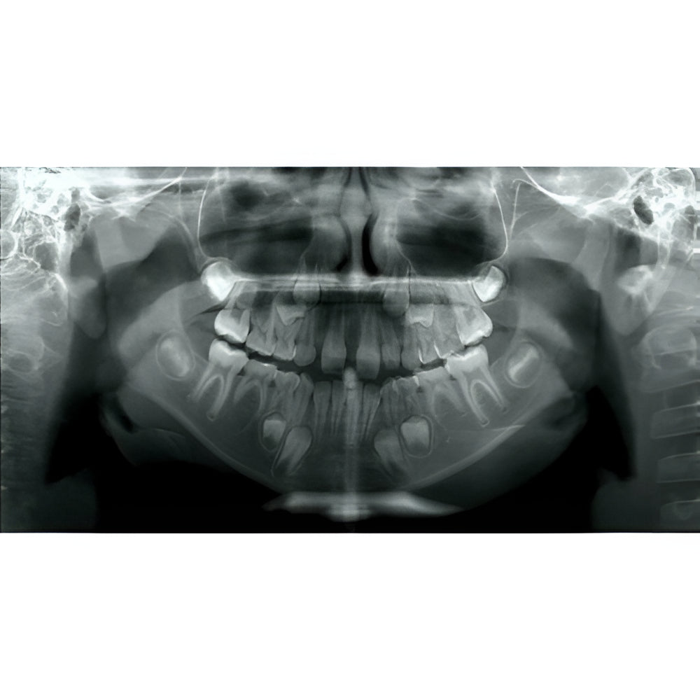 i-CAT FLX V10 Pan + CBCT (16x10 FOV)