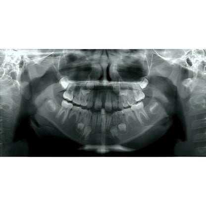 i-CAT FLX V10 Pan + CBCT (16x10 FOV)